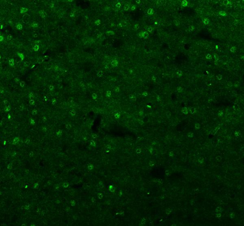 Islet 1/ISL1 Rabbit Polyclonal Antibody