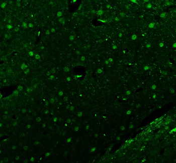 Islet 1/ISL1 Rabbit Polyclonal Antibody