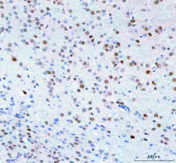 Islet 1/ISL1 Rabbit Polyclonal Antibody