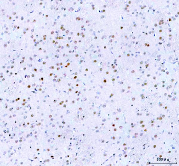Islet 1/ISL1 Rabbit Polyclonal Antibody
