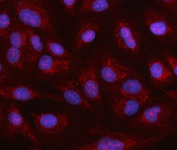HSPA12A Rabbit Polyclonal Antibody