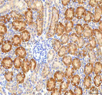 HSDL2 Rabbit Polyclonal Antibody