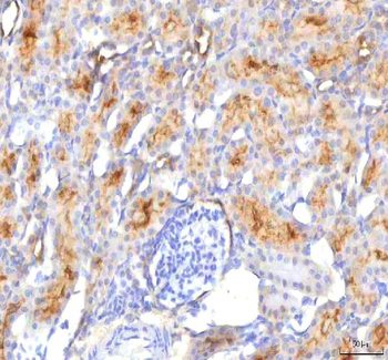 HSDL2 Rabbit Polyclonal Antibody