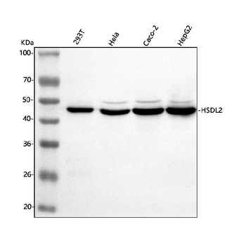 HSDL2 Rabbit Polyclonal Antibody