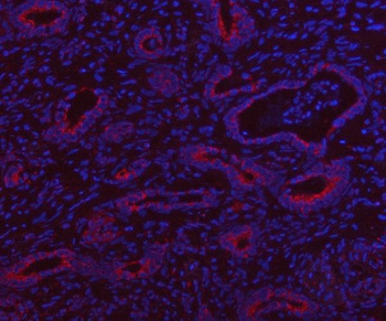 HSDL2 Rabbit Polyclonal Antibody