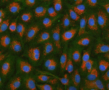 HSDL2 Rabbit Polyclonal Antibody
