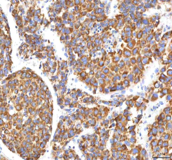 HSDL2 Rabbit Polyclonal Antibody