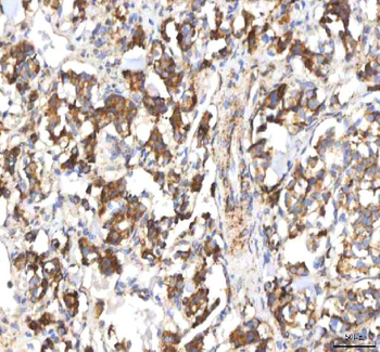 HSDL2 Rabbit Polyclonal Antibody