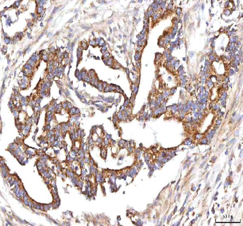 HSDL2 Rabbit Polyclonal Antibody