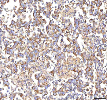 HSDL2 Rabbit Polyclonal Antibody