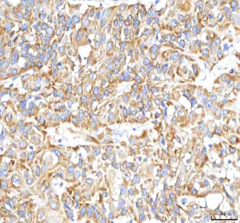 HSDL2 Rabbit Polyclonal Antibody