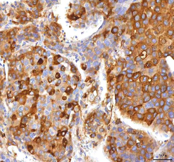HSD17B13 Rabbit Polyclonal Antibody