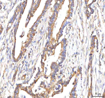 HSD17B13 Rabbit Polyclonal Antibody