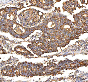 ITPA Rabbit Polyclonal Antibody