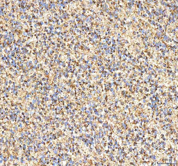 ITPA Rabbit Polyclonal Antibody