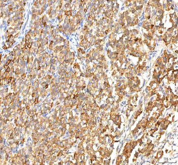 ITPA Rabbit Polyclonal Antibody