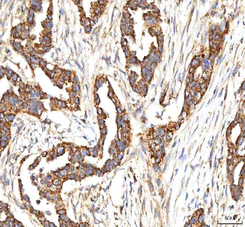 ITPA Rabbit Polyclonal Antibody