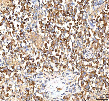 ITPA Rabbit Polyclonal Antibody