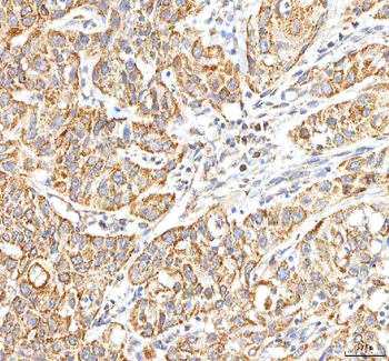 ITPA Rabbit Polyclonal Antibody