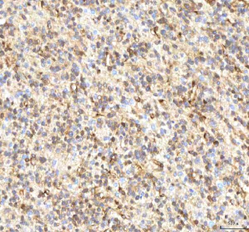 ISYNA1 Rabbit Polyclonal Antibody