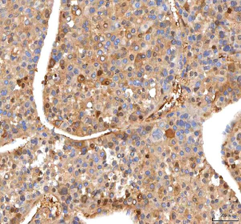 ISYNA1 Rabbit Polyclonal Antibody