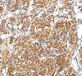 ISYNA1 Rabbit Polyclonal Antibody