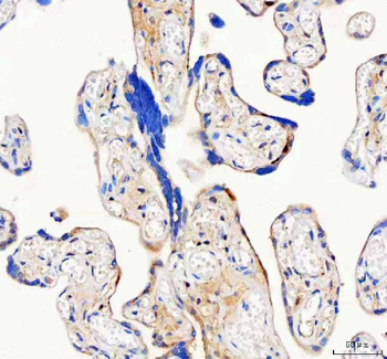 ISYNA1 Rabbit Polyclonal Antibody