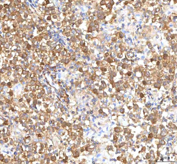 ISYNA1 Rabbit Polyclonal Antibody