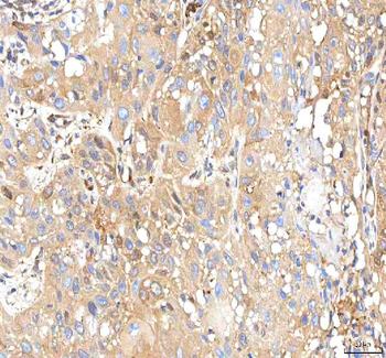 ISYNA1 Rabbit Polyclonal Antibody