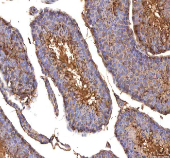 ISYNA1 Rabbit Polyclonal Antibody