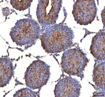 ISYNA1 Rabbit Polyclonal Antibody