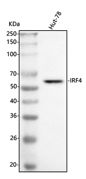 MUM1/IRF4 Rabbit Polyclonal Antibody