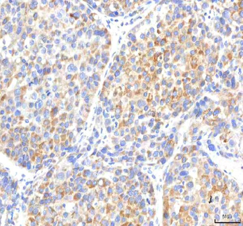 IPO8 Rabbit Polyclonal Antibody