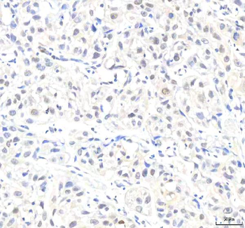 IPO8 Rabbit Polyclonal Antibody
