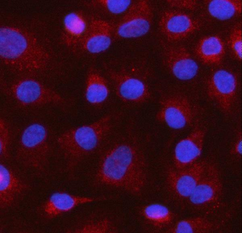 MOCS1 Rabbit Polyclonal Antibody