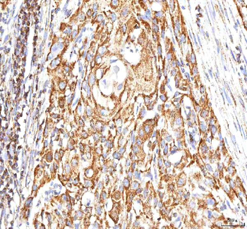 Calreticulin/CALR Antibody