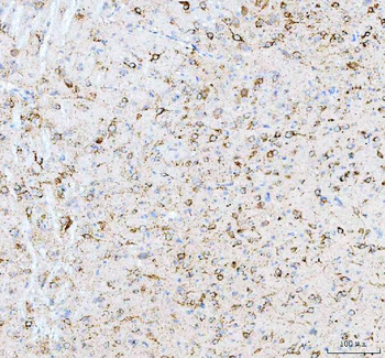 Calreticulin/CALR Antibody
