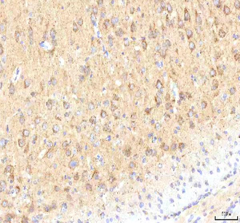 Calreticulin/CALR Antibody