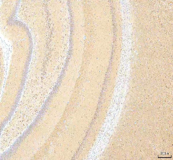 Calreticulin/CALR Antibody