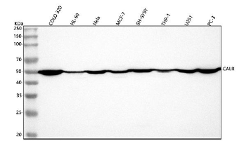 Calreticulin/CALR Antibody