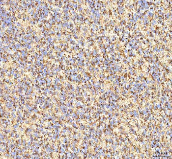 Calreticulin/CALR Antibody