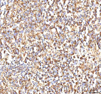 Calreticulin/CALR Antibody