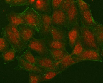 NUDT15 Rabbit Polyclonal Antibody