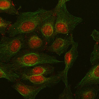 PKP2 Rabbit Polyclonal Antibody