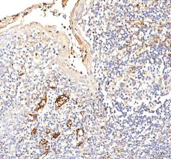 PKP2 Rabbit Polyclonal Antibody