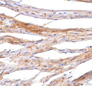 PKP2 Rabbit Polyclonal Antibody