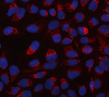 HTRA2 Rabbit Polyclonal Antibody