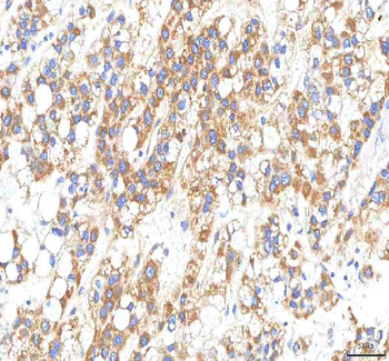 HTRA2 Rabbit Polyclonal Antibody