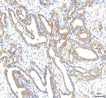 HTRA2 Rabbit Polyclonal Antibody