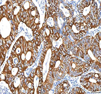 SGK493/PKDCC Rabbit Polyclonal Antibody